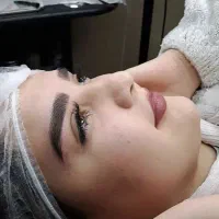میکروبیلدینگ،فیبروز ابرو، تربت حیدریه