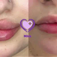 کلینک تخصصی میرا (فیلر، بوتاکس، نخ، میکرونیدلینگ|خدمات آرایشگری و زیبایی|کرج, چهارصد دستگاه|دیوار
