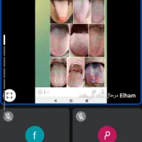 مشاوره طب سلامت باش انلان و رایگان در منزل