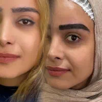 جشنواره کاشت ابرو با تکنیک نانو،میکروکاشت(اقساطی)