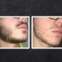 تار هاتو ضخیم کن