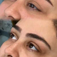یک مدل فیبروز کرکی مویی در آکادمی توسط اریشگر ماهر