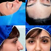 جراحی بینی در تهران با آف ۵۰درصد،جشنواره آذر|خدمات آرایشگری و زیبایی|پاکدشت, پاکدشت (مامازند)|دیوار