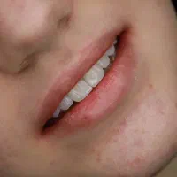 خدمات کلینیک دندانپزشکی|استخدام سرایداری و نظافت|تهران, شهران شمالی|دیوار