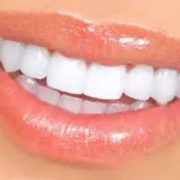 آموزش کامپوزیت دندان