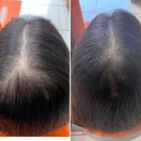 رفع چربی مو و ایجاد پرپشتی