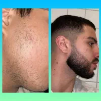 جذابیت در 20روز