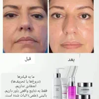 پوستت لایق یه تغییر خاصه|خدمات آرایشگری و زیبایی|شاندیز, |دیوار