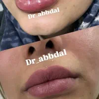 خدمات زیبایی بدن وصورت|خدمات آرایشگری و زیبایی|اصفهان, ملک‌شهر|دیوار