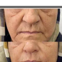 کرم گاتیو ضد چین و چروک اصل نمایندگی قم|آرایشی، بهداشتی، درمانی|قم, صفائیه|دیوار