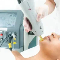 استخدام اپراتور خانم / مسلط به دستگاه لیزر کندلا