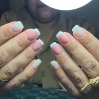 کاشت ناخن ۱۴۵۰۰۰