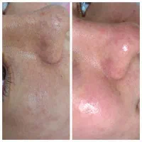 پاکسازی(faical)تخصصی در کلینیک زیبایی اردبیل