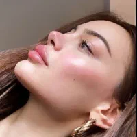 ژل بوتاکس150کلینیک پوست آموزش نخ ژل هایفو|خدمات آرایشگری و زیبایی|تهران, زعفرانیه|دیوار