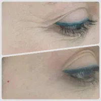 خدمات زیبایی با شرایط اقساط