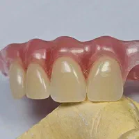 دندانسازی تخصصی پروتز دندان