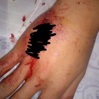 بخیه پانسمان تزریقات سرم تراپی پیرسینگ