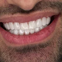 تخفیفات ویژه دندانپزشکی در ایذه