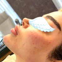 تزریق فیلر صورت مطابق المانهای زیبایی شناسی|خدمات آرایشگری و زیبایی|قرچک, پویینک|دیوار