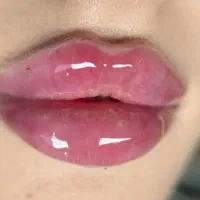 لیزر موهای زائد با دستگاه تیتانیوم پلاس 2024