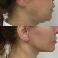 یلدا خوش اندام شودستگاه های لاغری مطب فارابی