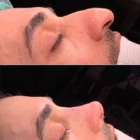 جشنواره جراحی وعمل بینی با متخصص گوش حلق بینی|خدمات آرایشگری و زیبایی|فردیس, طالقانی|دیوار