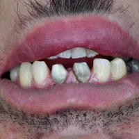 کامپوزیت و لمینیت اقساط|خدمات آرایشگری و زیبایی|اصفهان, ملک|دیوار