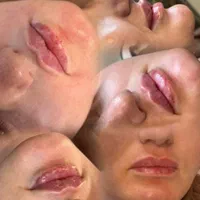 به چند نفر مدل تزریق ژل و بوتاکس نیازمندیم|خدمات آرایشگری و زیبایی|ارومیه, |دیوار