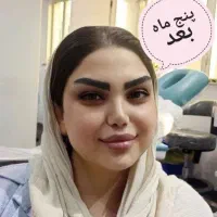 کاشت مو و ابرو اقساطی