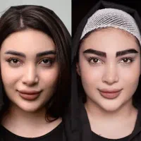 میکروکاشت ابرو و مو فقط 16.800 ظرفیت محدود|خدمات زیبایی و سلامت|قم, زنبیل آباد|دیوار