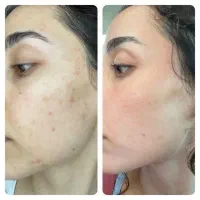 فقط در یک دوره(بیوممتیک)