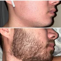 این اقدام اخریشه
