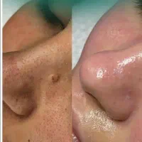 پاکسازی پوست با مواد مرغوب و بخور گرم فقط فقط ۳۵۰