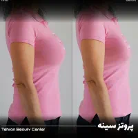 لیزیک چشم /لیپوماتیک /آبدومینو/ کاشت مو/بلفارو|خدمات آرایشگری و زیبایی|کرمانشاه, |دیوار