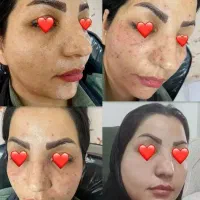 تخفیف 50درصدی در هر لاین پوستی
