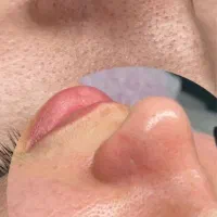 پاکسازی پوست وفیشال