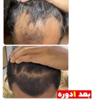 تونیک هیر فرند|آرایشی، بهداشتی، درمانی|شیراز, کوشک میدان|دیوار