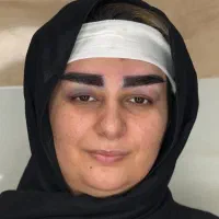 جشنواره کاشت ابرو با اقساط ویژه