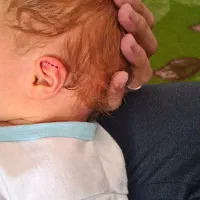 انواع فصد و انواع حجامت های تخصصی|خدمات آرایشگری و زیبایی|قم, کیوانفر|دیوار