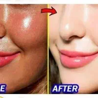 کرم سفید کننده صورت وبدن 10درجه سفیدی|آرایشی، بهداشتی، درمانی|مشهد, کوه سنگی|دیوار