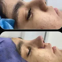 عمل بینی، لیپو شکم پهلو ،ابدو ،پروتز ولیفت سینه
