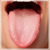 مشاوره و تشخیص بیماری از روی عکس زبان(رایگان)
