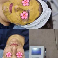 فیشیال تخصصی توسط پیراپزشک با۳۰٪تخفیف درکلینیک|خدمات آرایشگری و زیبایی|شیراز, خلدبرین|دیوار