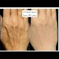 کرم ضد لک دست و صورت|آرایشی، بهداشتی، درمانی|شیراز, زیباشهر|دیوار