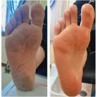 پدیکور و کفسابی پا|خدمات آرایشگری و زیبایی|شاهینشهر, خانه کارگر|دیوار