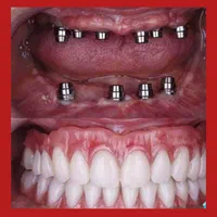 دندانپزشکی/ایمپلنت/لمینت/کامپوزیت زیبایی|خدمات آرایشگری و زیبایی|تهران, مهران (سیدخندان)|دیوار