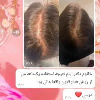 روغن تراپی|آرایشی، بهداشتی، درمانی|اهواز, عامری|دیوار