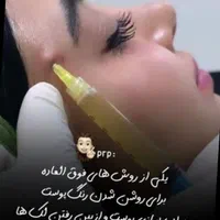 تزریق فیلر وبوتاکس مزو آنزیم پی ارپی و چربی|خدمات آرایشگری و زیبایی|کرمانشاه, |دیوار