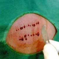 حجامت و زالودرمانی مرکز کهنوج|خدمات آرایشگری و زیبایی|کهنوج, |دیوار