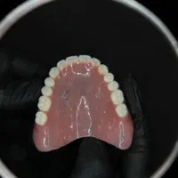 دندان مصنوعی و روکش